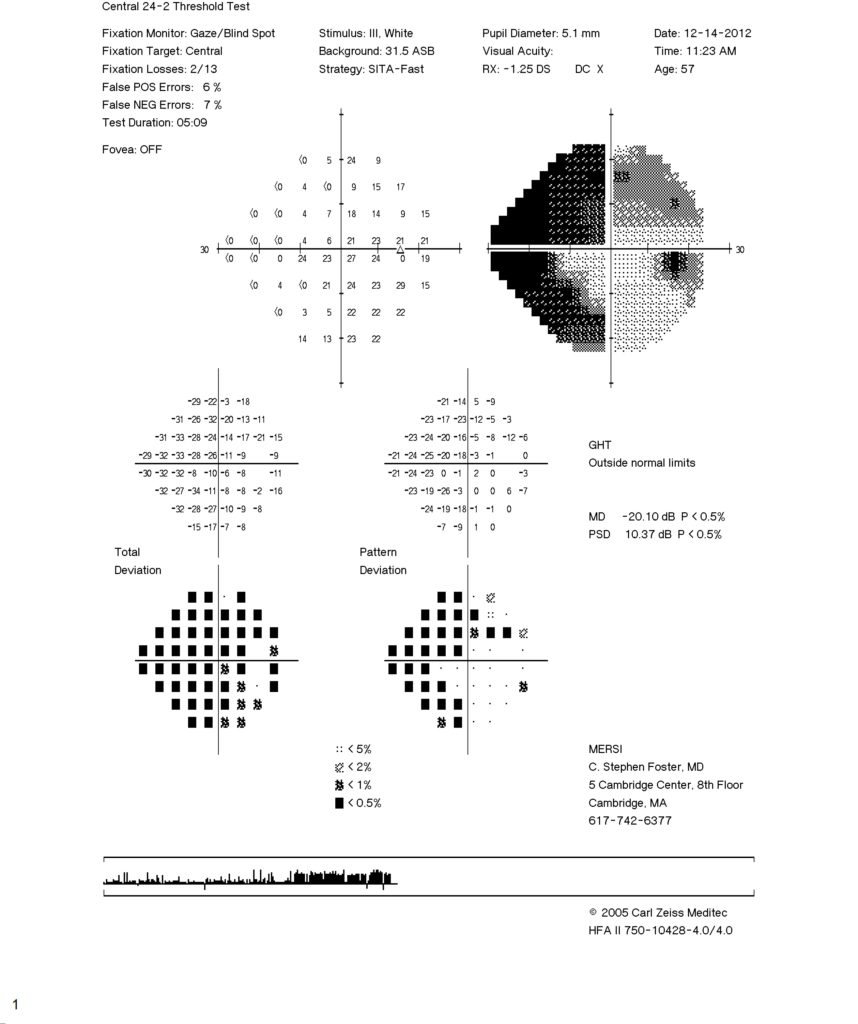 Visual Field Diagram