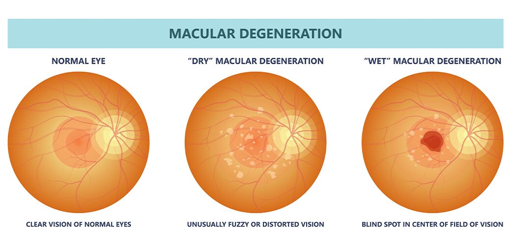 Conditions That Require Specialized Attention