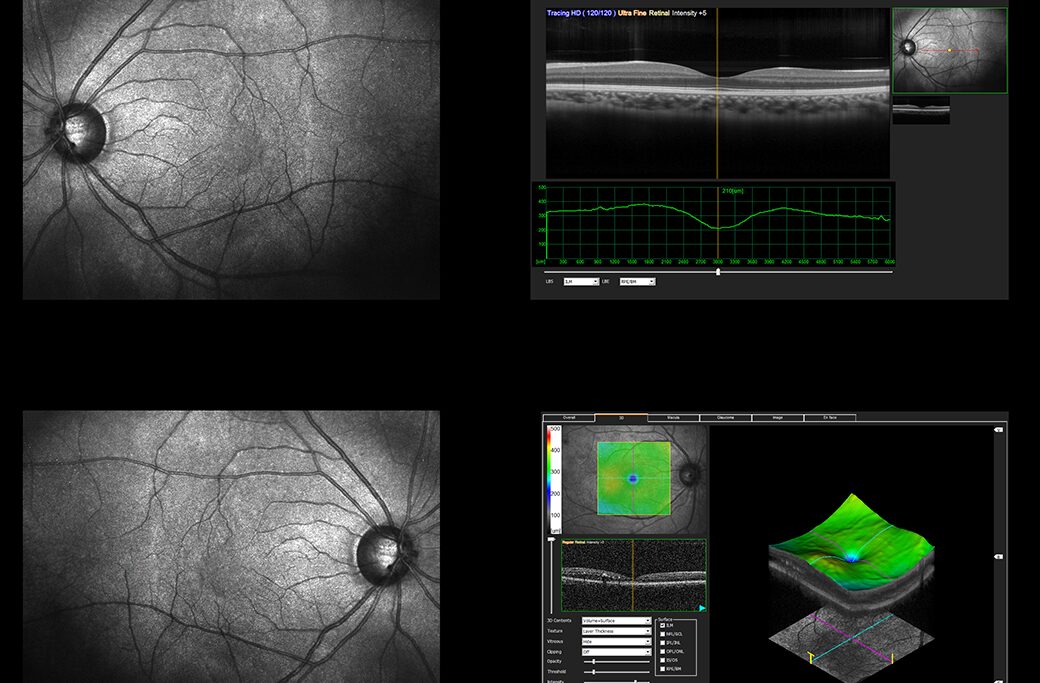 Why Patients Choose MERSI for Eye Care Near Boston