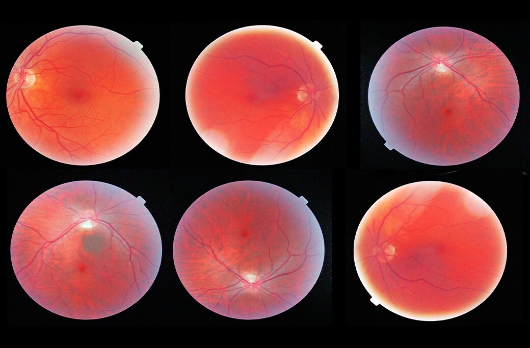 Why Newton Residents Choose MERSI