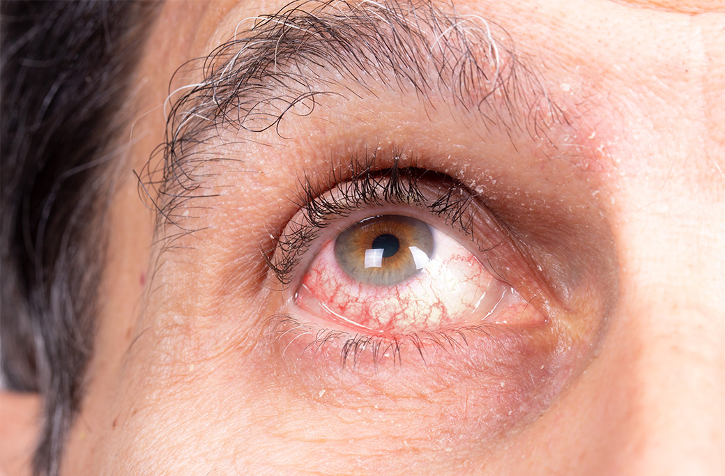 Conditions That May Require Pathology Evaluation