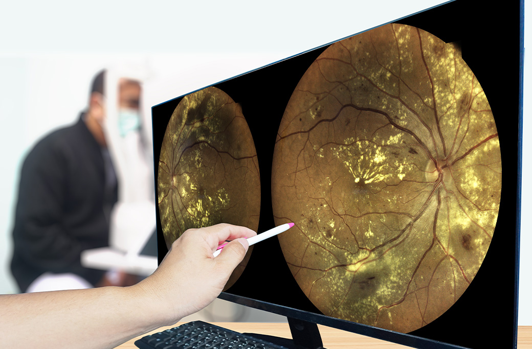 When Does Diabetic Retinopathy Become Dangerous?