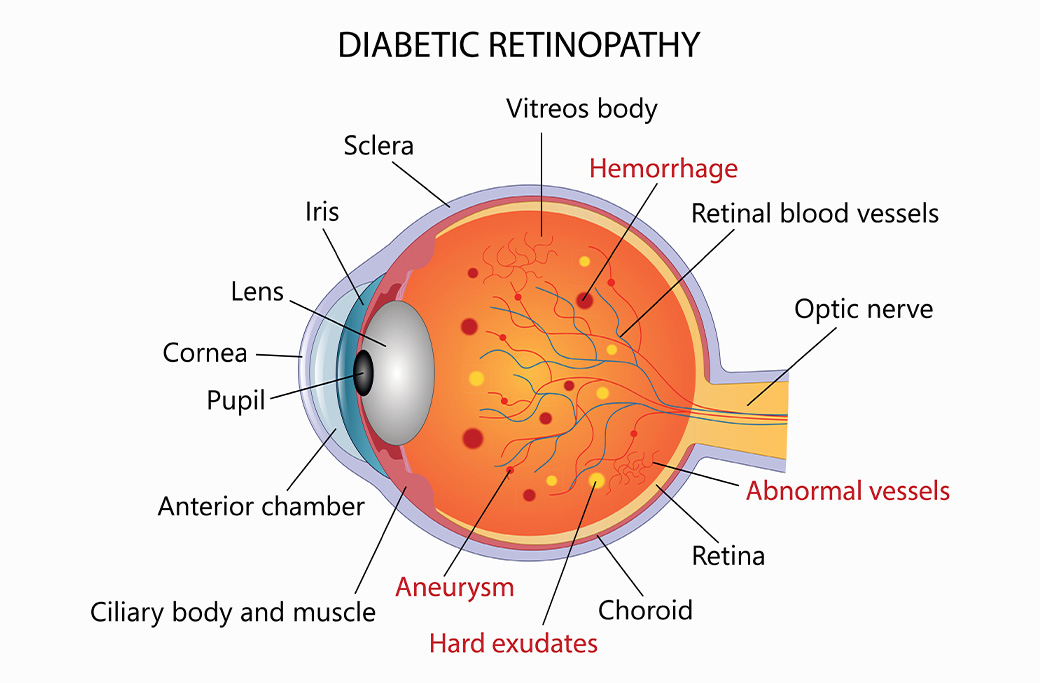 Why Early Eye Exams Matter