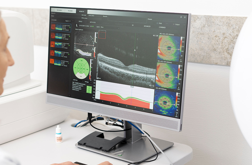 Which Imaging Tests Are Used To Diagnose Uveitis?