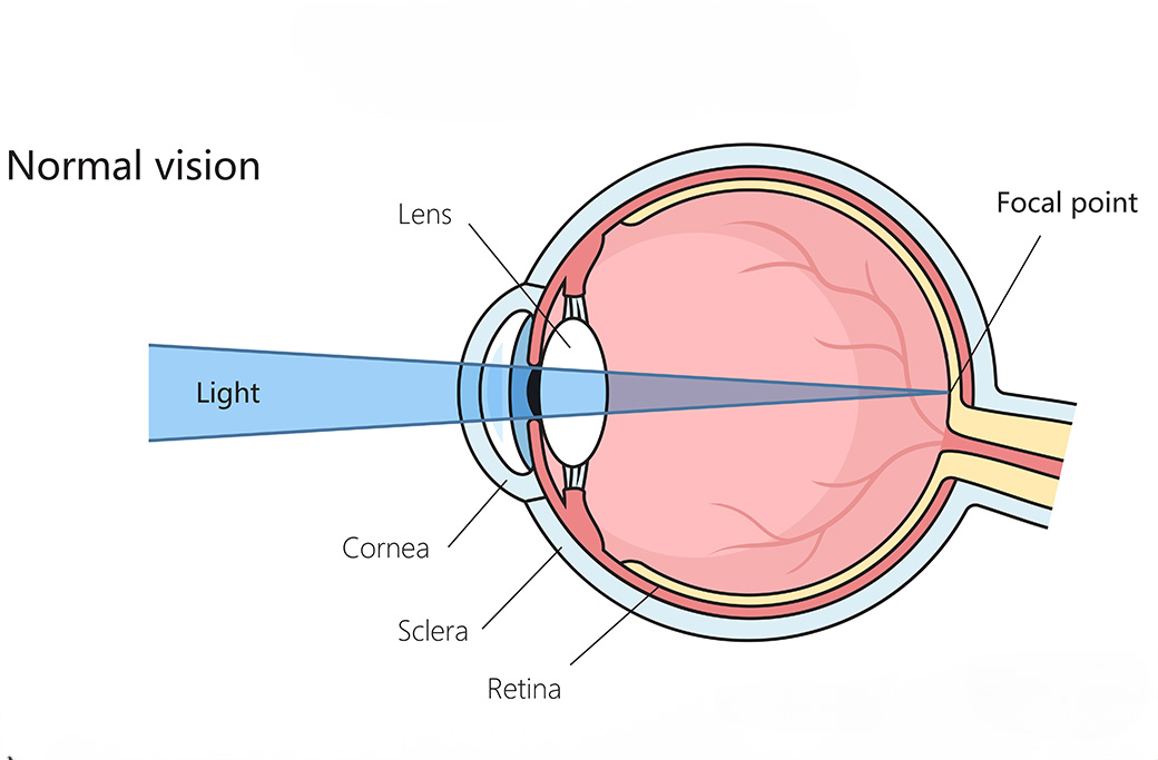 Diagram showing the cornea at the front of the eye.
