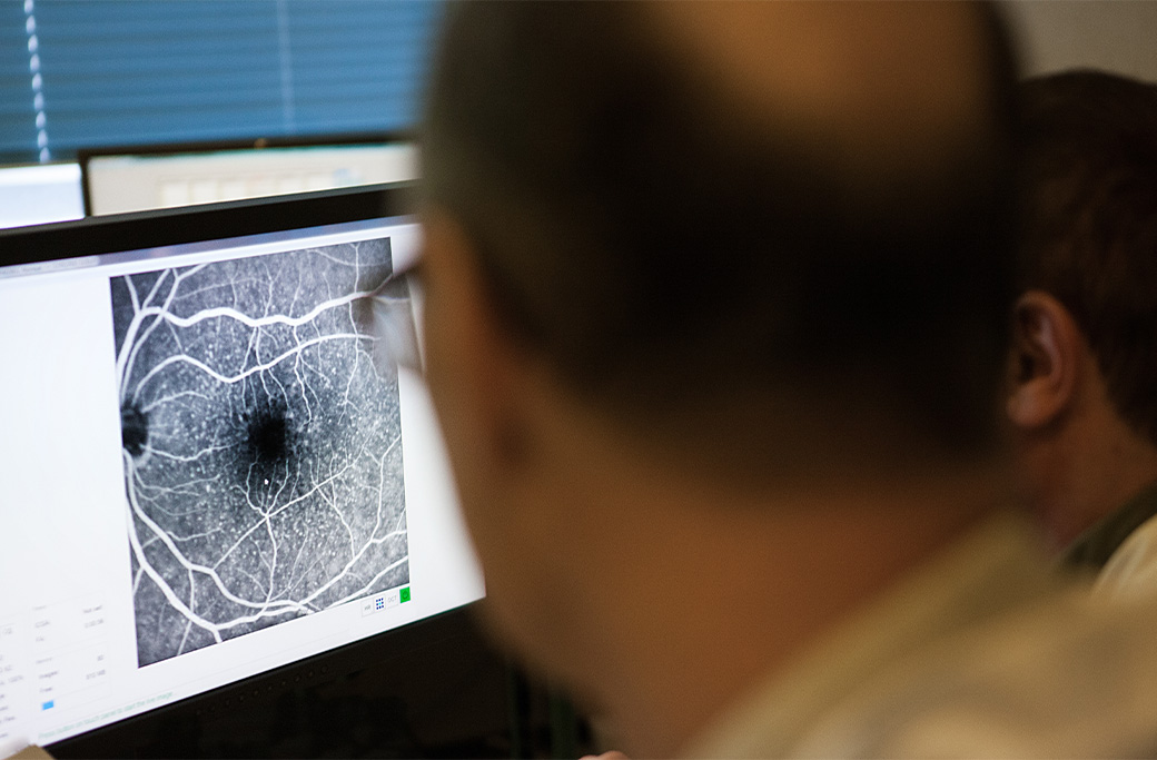 Clinician reviewing fluorescein angiography images of retinal blood vessels.