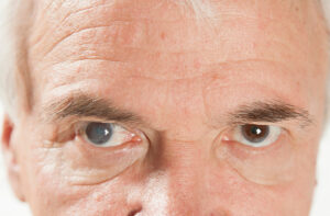 Cataracts vs Retinal Disease: What’s Causing Vision Changes?