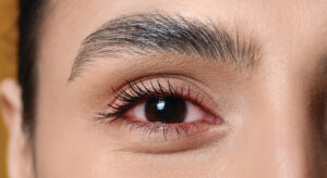 Is Uveitis a Sign of an Autoimmune Disease? Lupus, RA & More